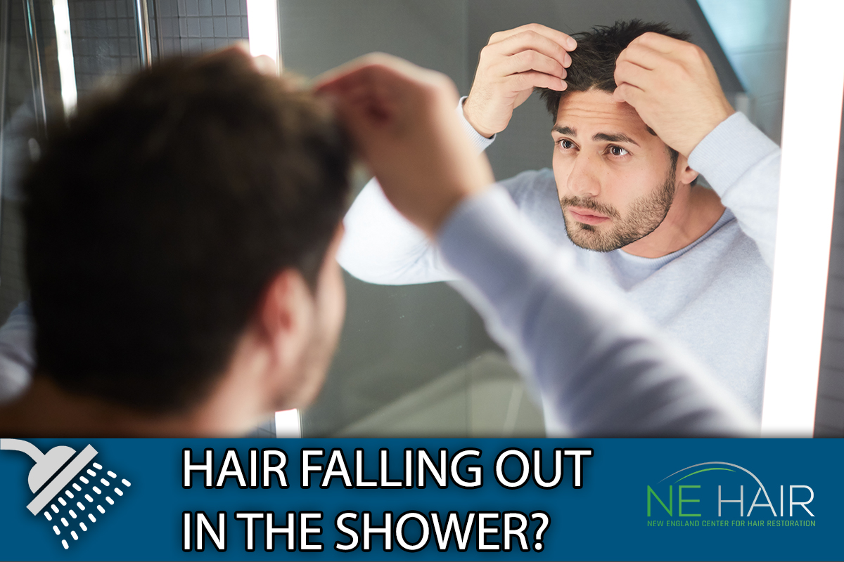 Is it Normal for Men to Lose Hair in the Shower Every Day? - Boston MA
