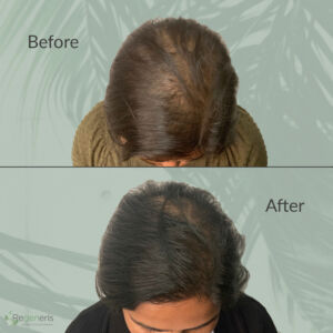 keralase hair therapy