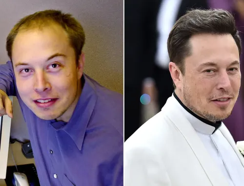 Elon Musk’s Hair Transformation: Unveiling His Hair Transplant Journey