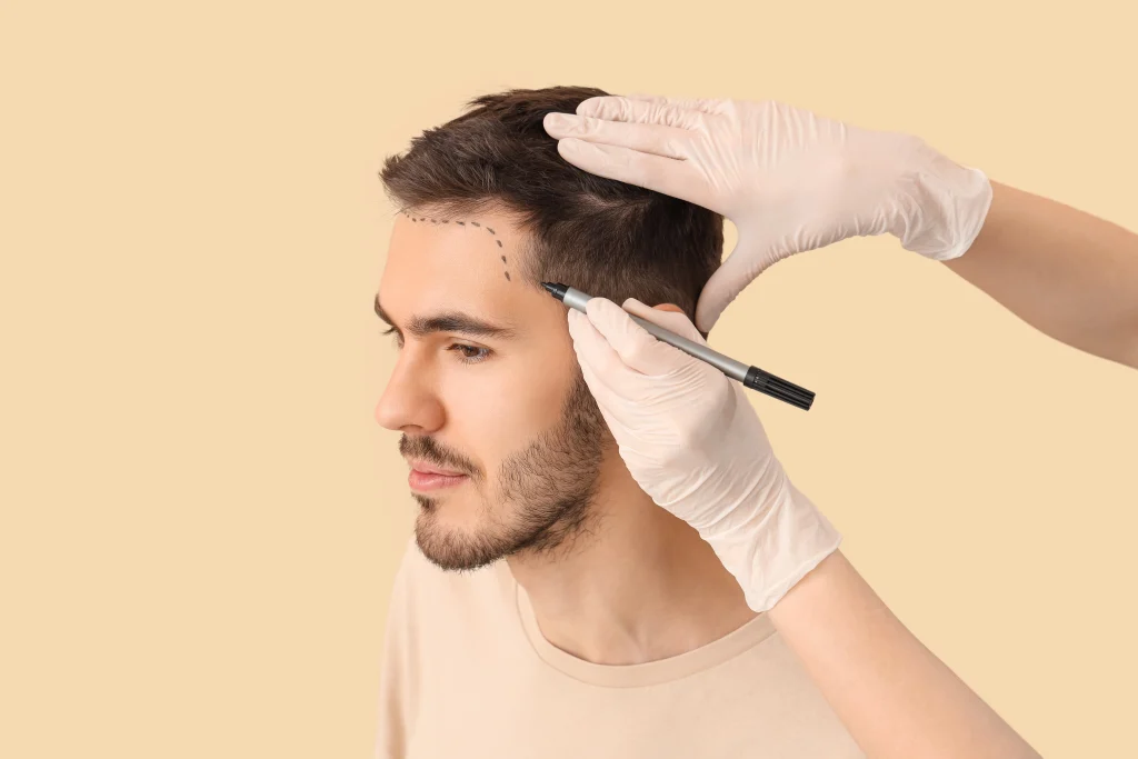 What to Know Before Your First Hair Transplant? A Pre-Op Checklist Banner