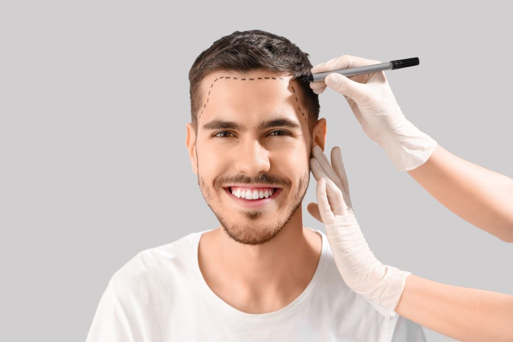 What to Expect During Your Hair Transplant Recovery Timeline? banner